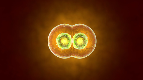 Pré-Leucémie, Syndromes Myélodysplasiques